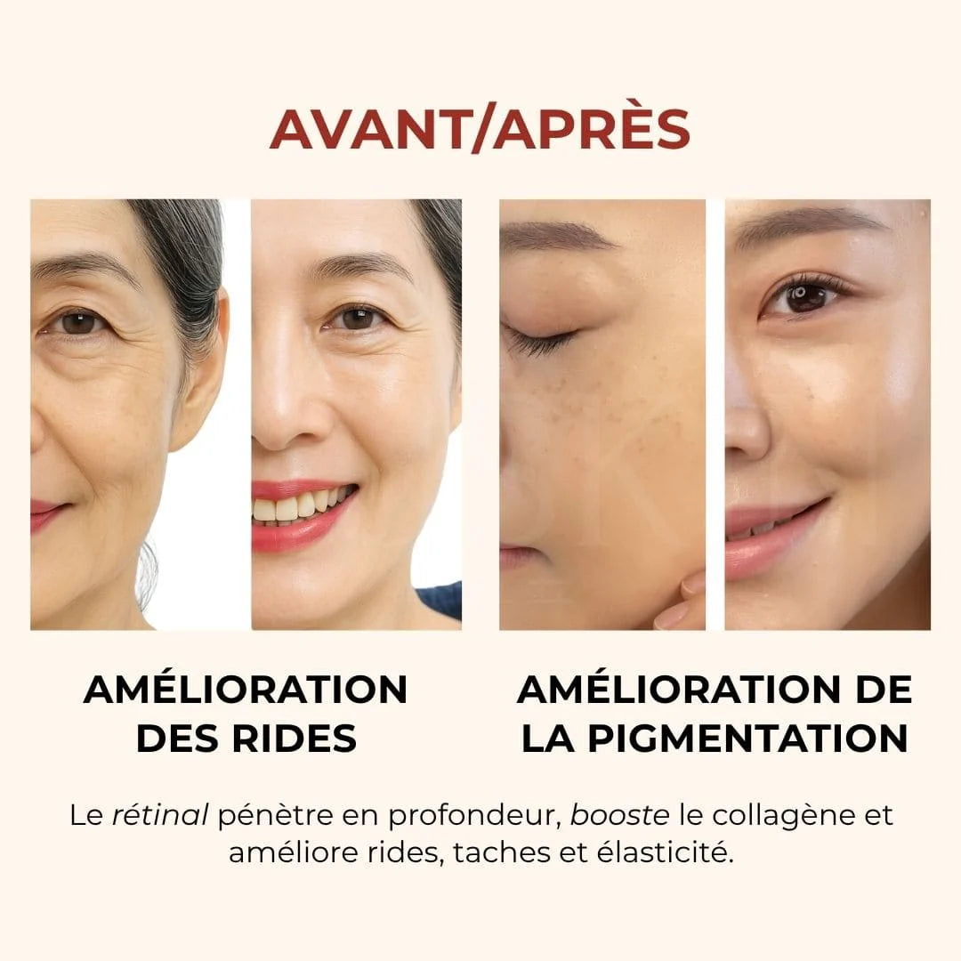 KIT DE 2 🌸 SEOUL 1988 – L’Essence de la Beauté Coréenne anti ride, anti tache , anti age